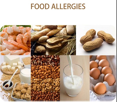 Food Allergies PDF